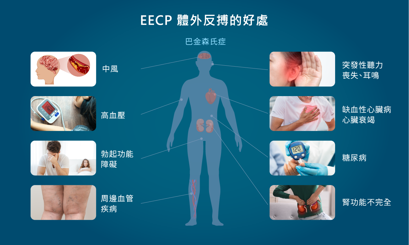 EECP 體外反搏的好處