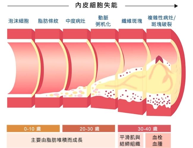 插圖示意高血糖與胰島素阻抗如何影響血管彈性與增加併發症風險